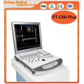 PT-C80plus chariot 3D Color Doppler échographe diagnostique